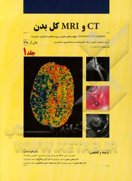 CT و MRI کل بدن: incranial neoplasms، عفونت‌های مغزی، پروسه‌های مننژیال، اوربیت ...