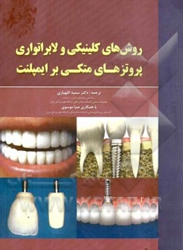 روش‌های کلینیکی و لابراتواری پروتزهای متکی بر ایمپلنت