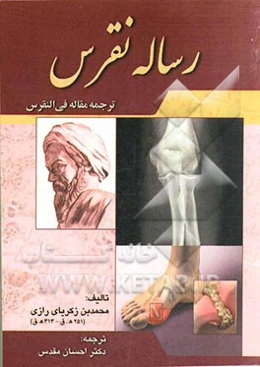 رساله نقرس (ترجمه مقاله فی النقرس)