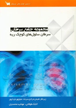 سرطان سلول‌های کوچک ریه