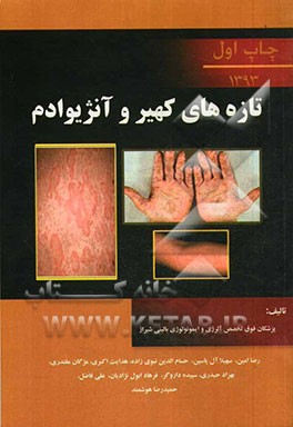 تازه‌های کهیر و آنژیوادم: به ضمیمه تازه‌های آلرژی