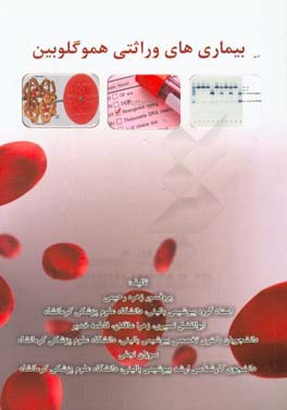 بیماری‌های وراثتی هموگلوبین (هموگلوبینوپاتی‌ها)