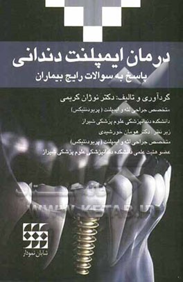 پاسخ به سوالات رایج بیماران درمان ایمپلنت دندانی