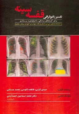 تفسیر رادیوگرافی قفسه‌ سینه برای گروه‌های پزشکی، رادیولوژی و پرستاری به انضمام تصاویر سی‌‌تی‌اسکن و نکات مهم برای آموزش بیشتر مفاهیم