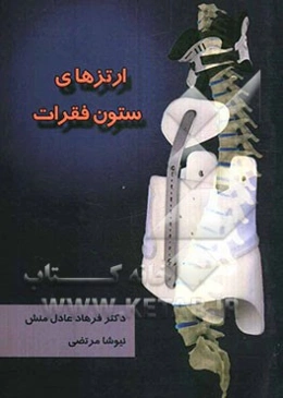 ارتزهای ستون فقرات