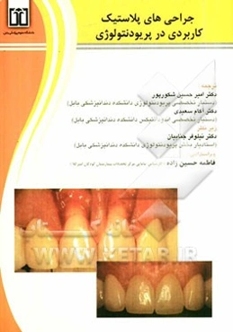 جراحی‌های پلاستیک کاربردی در پریودنتولوژی