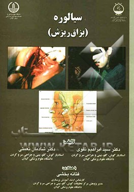 سیالوره (بزاق ریزش