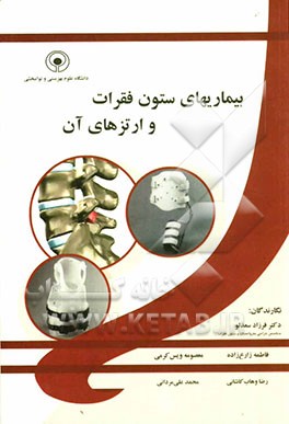 بیماریهای ستون فقرات و ارتزهای آن