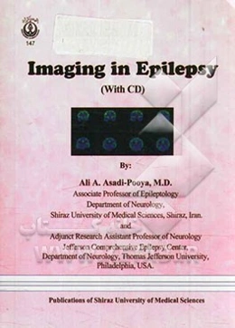 Imaging in epilepsy (with CD)