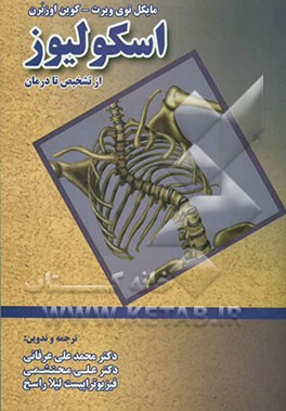 اسکولیوز: از تشخیص تا درمان