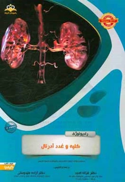 رادیولوژی: کلیه و غدد آدرنال: خلاصه درس به همراه مجموعه سوالات آزمون ارتقاء و بورد رادیولوژی با پاسخ تشریحی Haaga 2012