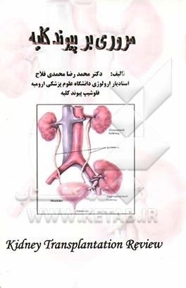 مروری بر پیوند کلیه