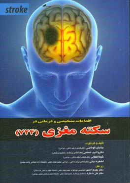 اقدامات تشخیصی و درمانی در سکته مغزی (724)
