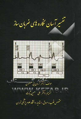 تفسیر آسان نگاره‌های ضربان ساز