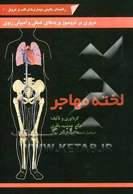 لخته مهاجر: مروری بر ترومبوز وریدهای عمقی و آمبولی ریوی