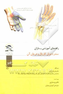 سندرم تونل کارپال و درمان آن