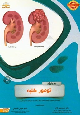 اورولوژی: تومور کلیه: خلاصه درس به همراه مجموعه سوالات آزمون ارتقاء و بورد اورولوژی با پاسخ تشریحی Campbell 2016