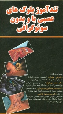 تندآموز بلوک‌های عصبی با و بدون سونوگرافی