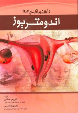 راهنمای جامع اندومتریوز