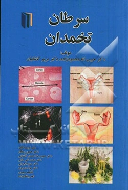 سرطان تخمدان