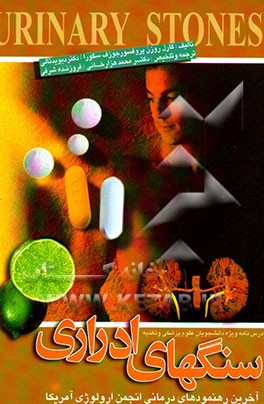 سنگ‌های ادراری: آخرین رهنمودهای درمانی انجمن ارولوژی آمریکا