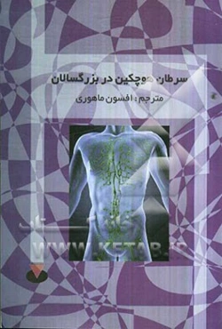 سرطان هوچکین