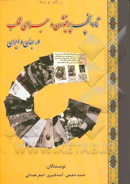 تاریخچه پرفیوژن و جراحی قلب در جهان و ایران