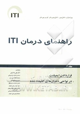 راهنمای درمان ITI: قراردادن ایمپلنت در نواحی دندان‌های کشیده شده: روش‌های مختلف درمان