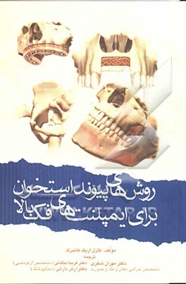 روش‌های پیوند استخوان برای ایمپلنت‌های فک بالا