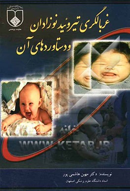 غربالگری تیروئید نوزادان و دستاوردهای آن