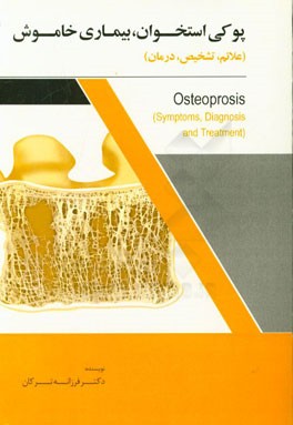 پوکی استخوان، بیماری خاموش (علائم، تشخیص،‌ درمان)