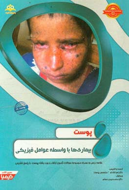 پوست: بیماریها با واسطه عوامل فیزیکی: خلاصه درس به همراه مجموعه سوالات آزمون ارتقاء و بورد پوست با پاسخ تشریحی