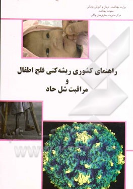 راهنمای کشوری ریشه‌کنی فلج اطفال و مراقبت فلج شل حاد