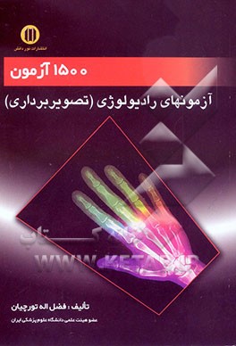 1500 آزمون پرتونگاری