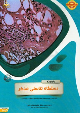 پاتولوژی: دستگاه تناسلی مذکر: خلاصه درس به همراه مجموعه سوالات آزمون ارتقاء و بورد پاتولوژی با پاسخ تشریحی