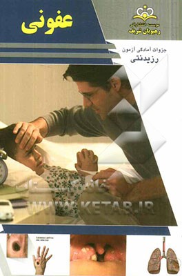 عفونی: مرجع 91 (هاریسون 2012)