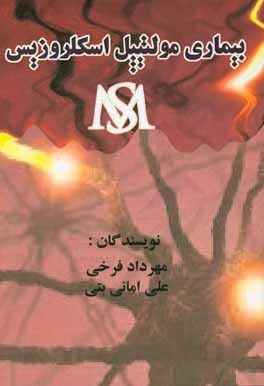 بیماری مولتیپل اسکلروزیس