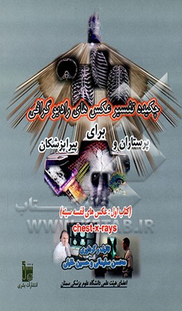 چکیده تفسیر عکس‌های رادیوگرافی برای پرستاران و پیراپزشکان: (کتاب اول: عکس‌های قفسه سینه) = Chest - X - Rays