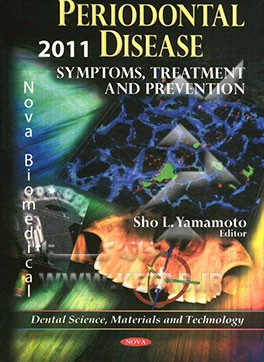 Periodontal disease: symptoms, treatment and prevention