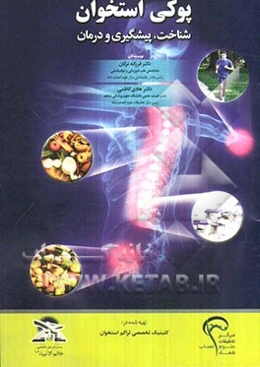 پوکی استخوان: شناخت، پیشگیری و درمان