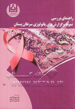 راهنمای بررسی نمونه و گزارش‌های پاتولوژی سرطان پستان = Protocol for the examination of specimens from patients with ductal carcinoma in Situ (DCIS) of
