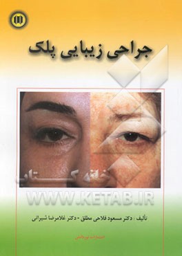 جراحی زیبایی پلک