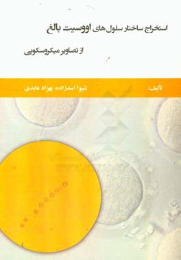 استخراج ساختار سلول‌های اووسیت بالغ از تصاویر میکروسکوپی