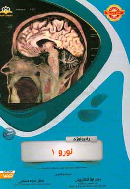 رادیولوژی: نورو 1: خلاصه درس به همراه مجموعه سوالات آزمون ارتقاء و بورد رادیولوژی با پاسخ تشریحی ...