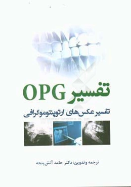 تفسیر OPG: تفسیر عکس‌های ارتوپنتوموگرافی