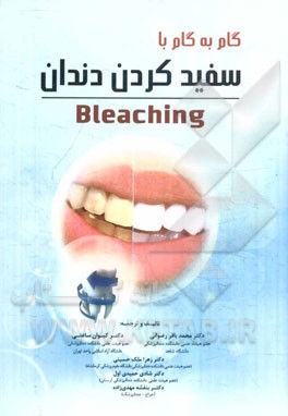 گام به گام با سفید کردن دندان (Bleaching)