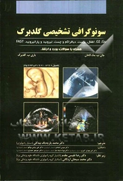 سونوگرافی تشخیصی گلدبرگ