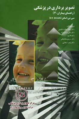 سی‌تی‌اسکن (CT.SCAN