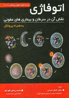 اتوفاژی، نقش آن در سرطان و بیماری‌های عفونی (به همراه پروتکل)