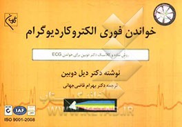 خواندن فوری الکتروکاردیوگرام